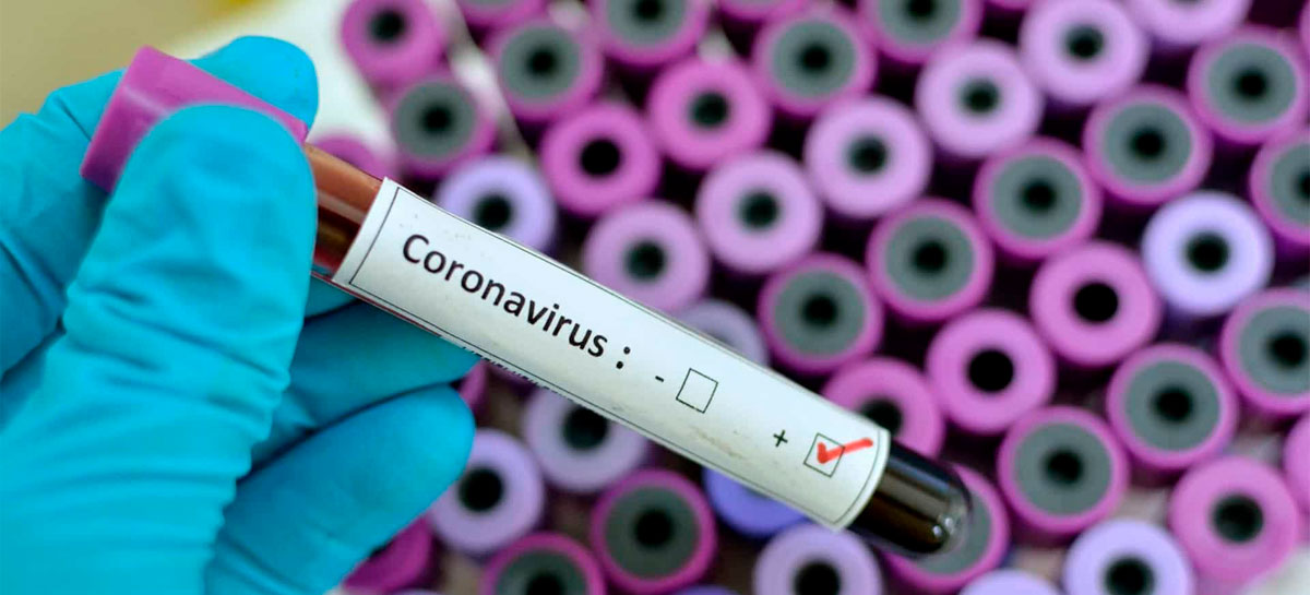 Imagem ilustrativa - Coronavírus
